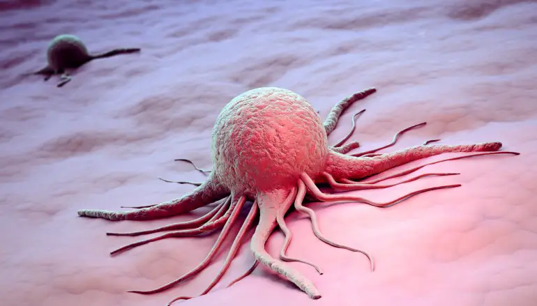 Ecco il farmaco che mette a dieta il cancro