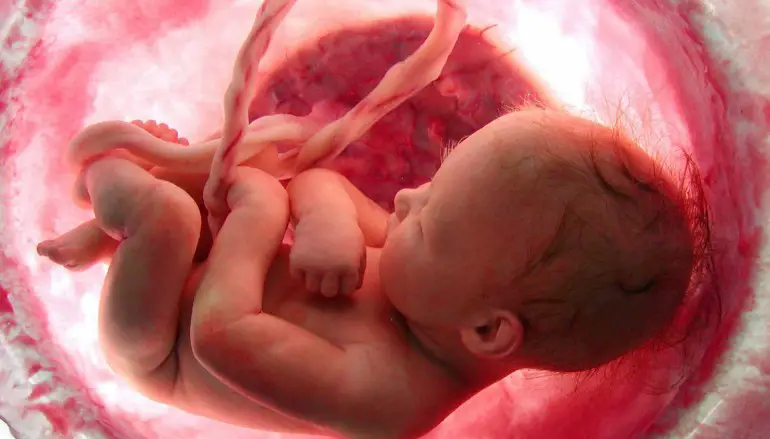 Il Miracolo tra significato e antiche culture