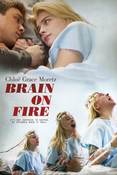 brain on fire